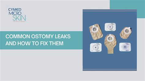 Understanding and Managing Ostomy Bag Leaks: Causes and。